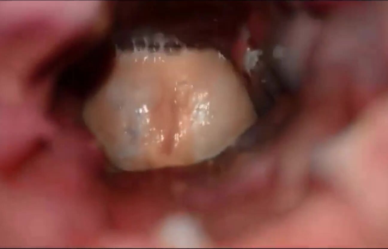 MelissaDeluxe Abgerotzt in der Votze Extreme Aufnahme MyDirtyHobby