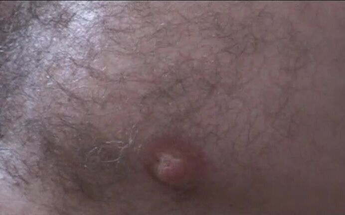 Mistresskent Kunty Cbtnt