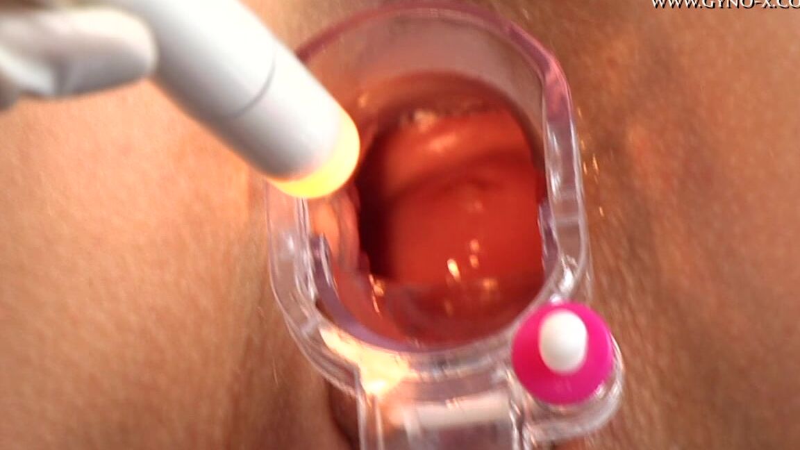 "Mix"  Iris Gyno Exam_2 SiteRip