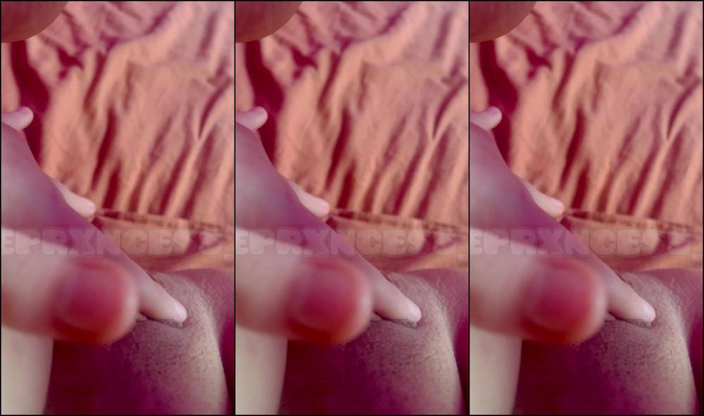 Eprxncess V1 3200693309 02 14 2024 I M Almost 3 Weeks Post Op To Celebrate I M Posting All These Never Before Pictures And