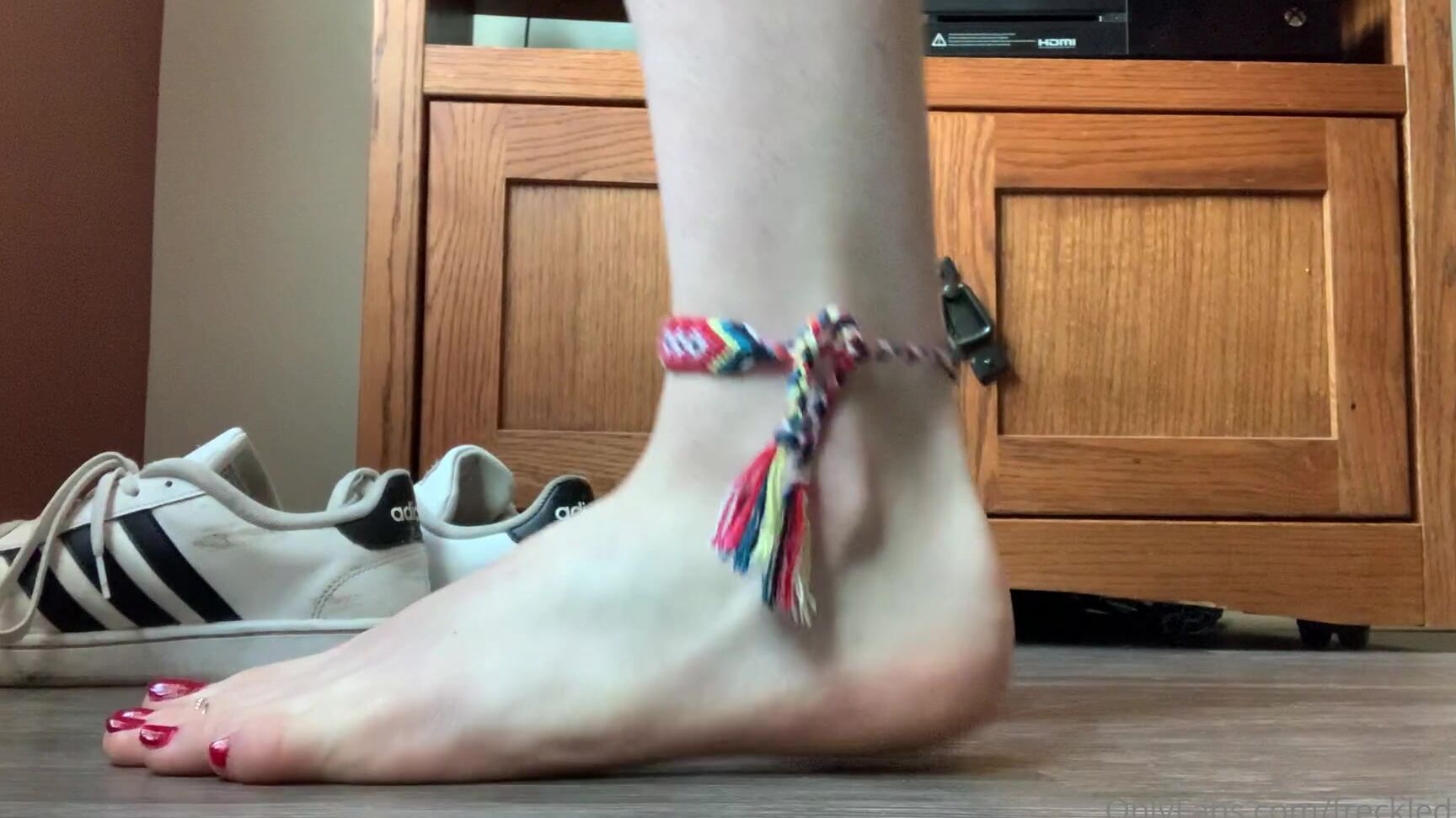 Freckled Feet Sweaty Feet Anyone