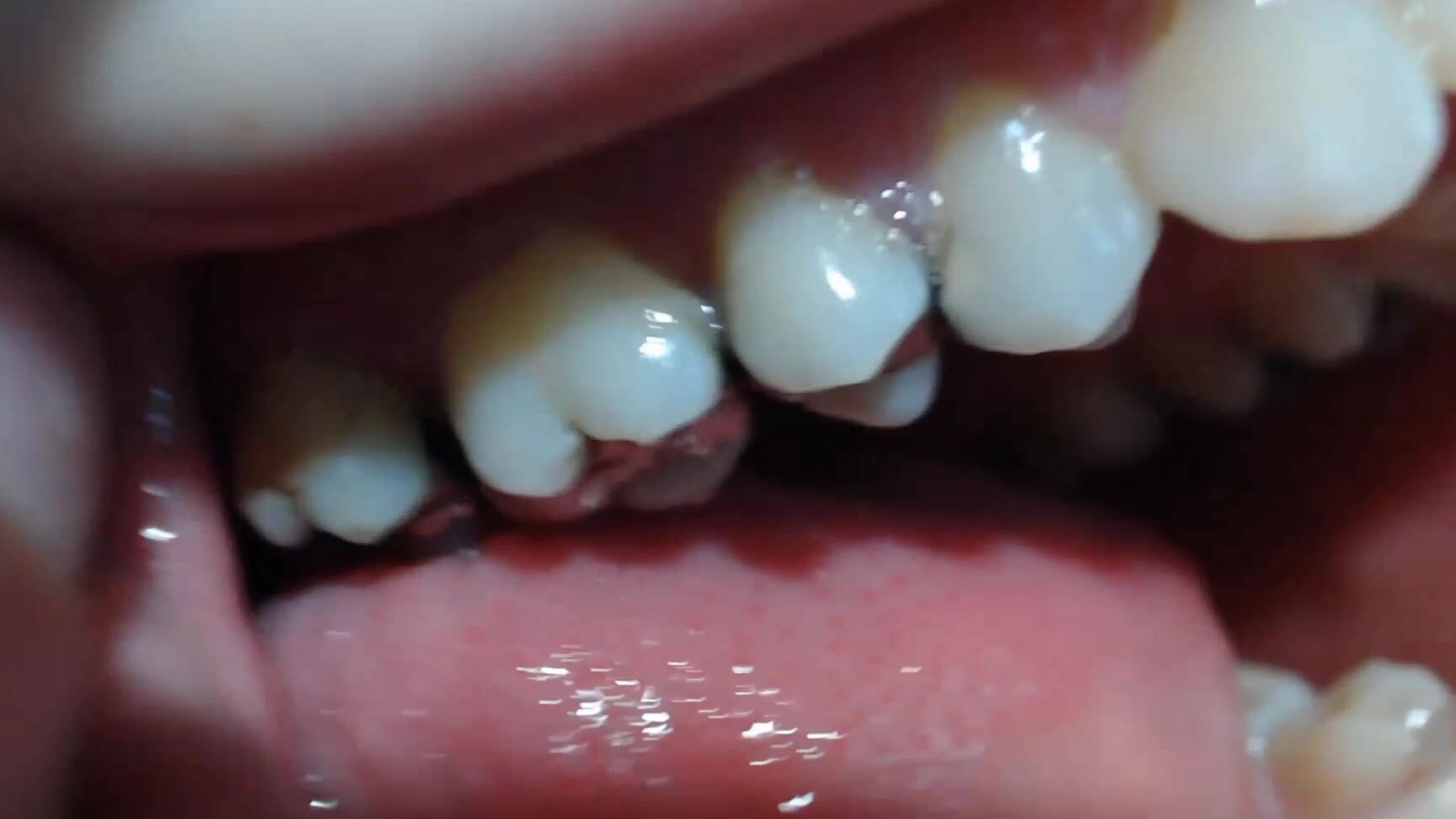 Booty U Hang Out Inside My Mouth