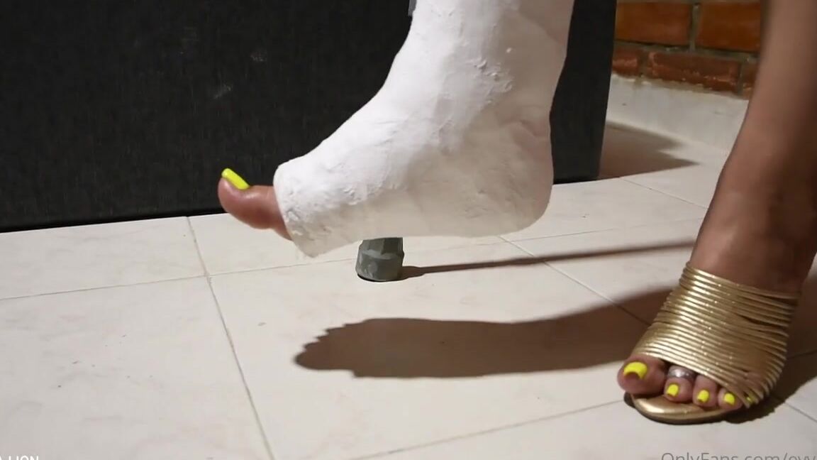 Evvalion Nicknamed Evvalion 03 27 2021 Onlyfans Video Im Walking In Crutches With My Slc Ouchh Poor My Broken Leg