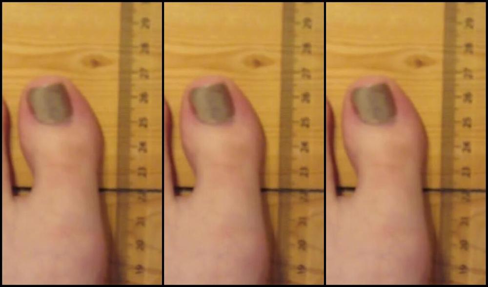 Neolasoles Nicknamed Neolasoles Onlyfans Video 7402