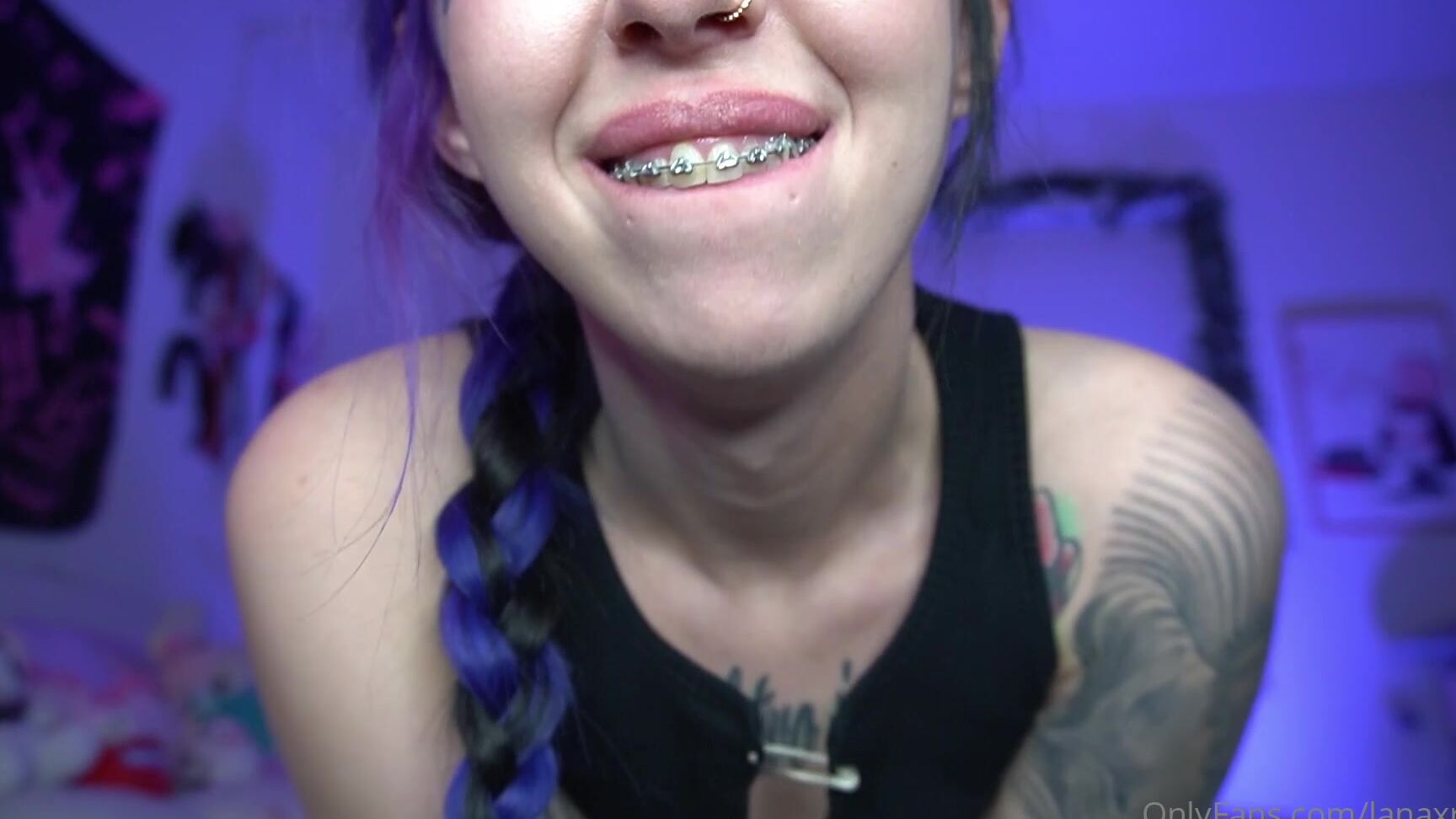 Lanaxreign I Tell You All About My Braces In This Video Because You Ve Recently Confessed To Me You