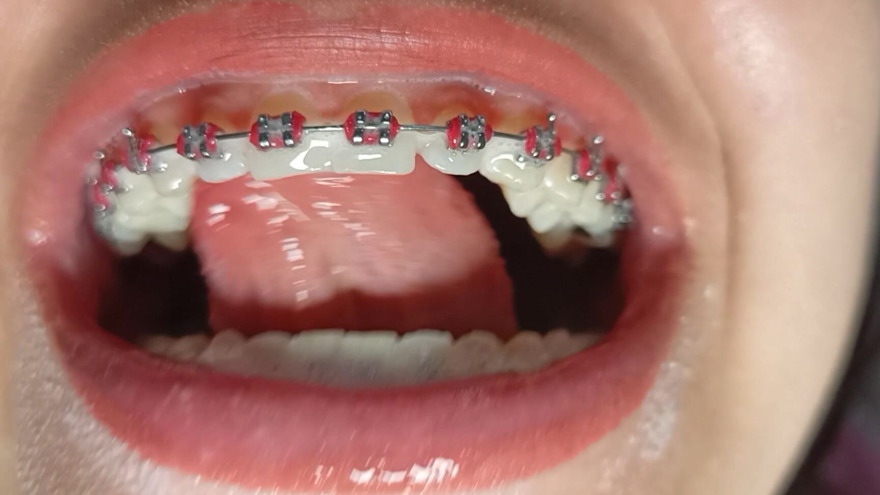 Braces,Teeth,Tongue Fetish,Toothbrushing,Uvula Fetish miaisabella3 tooth brushing asmr ManyVids