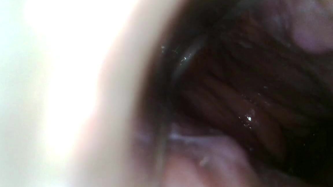 Xamy Endoscope Up My Butt