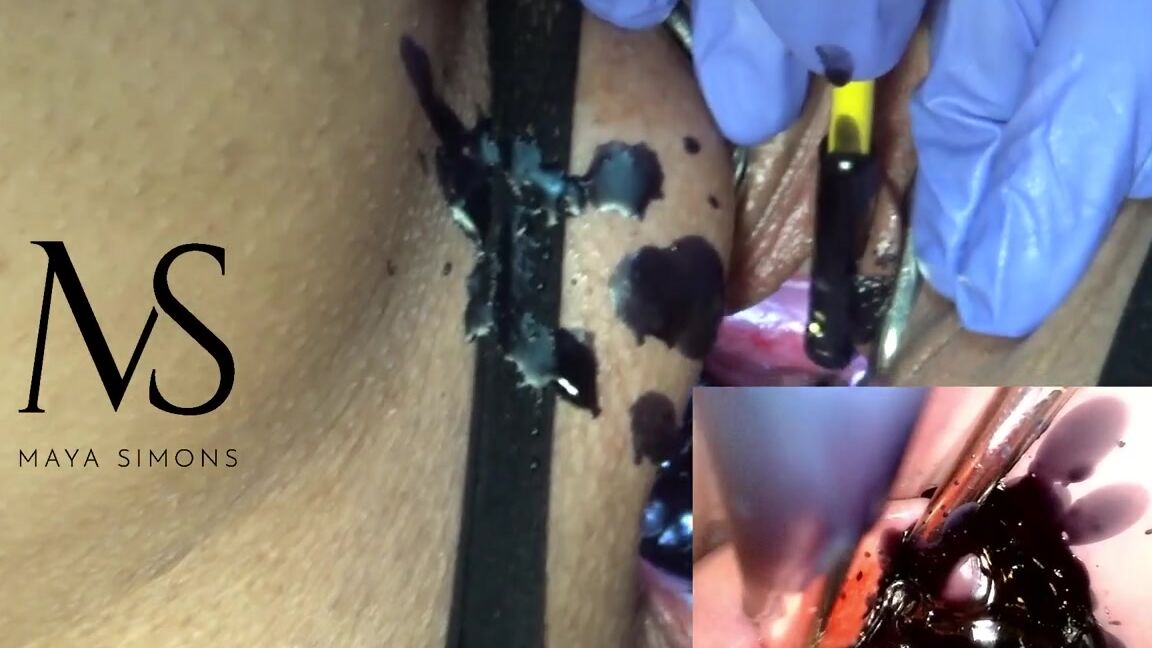 Extrema Maya Simons Halloween Extreme Cervix Burning With Black Candlep