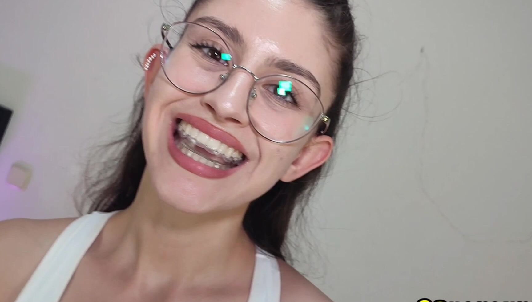 Shanaxnow My Fetish Orthodontic Retainer Brace Tongue Teeth