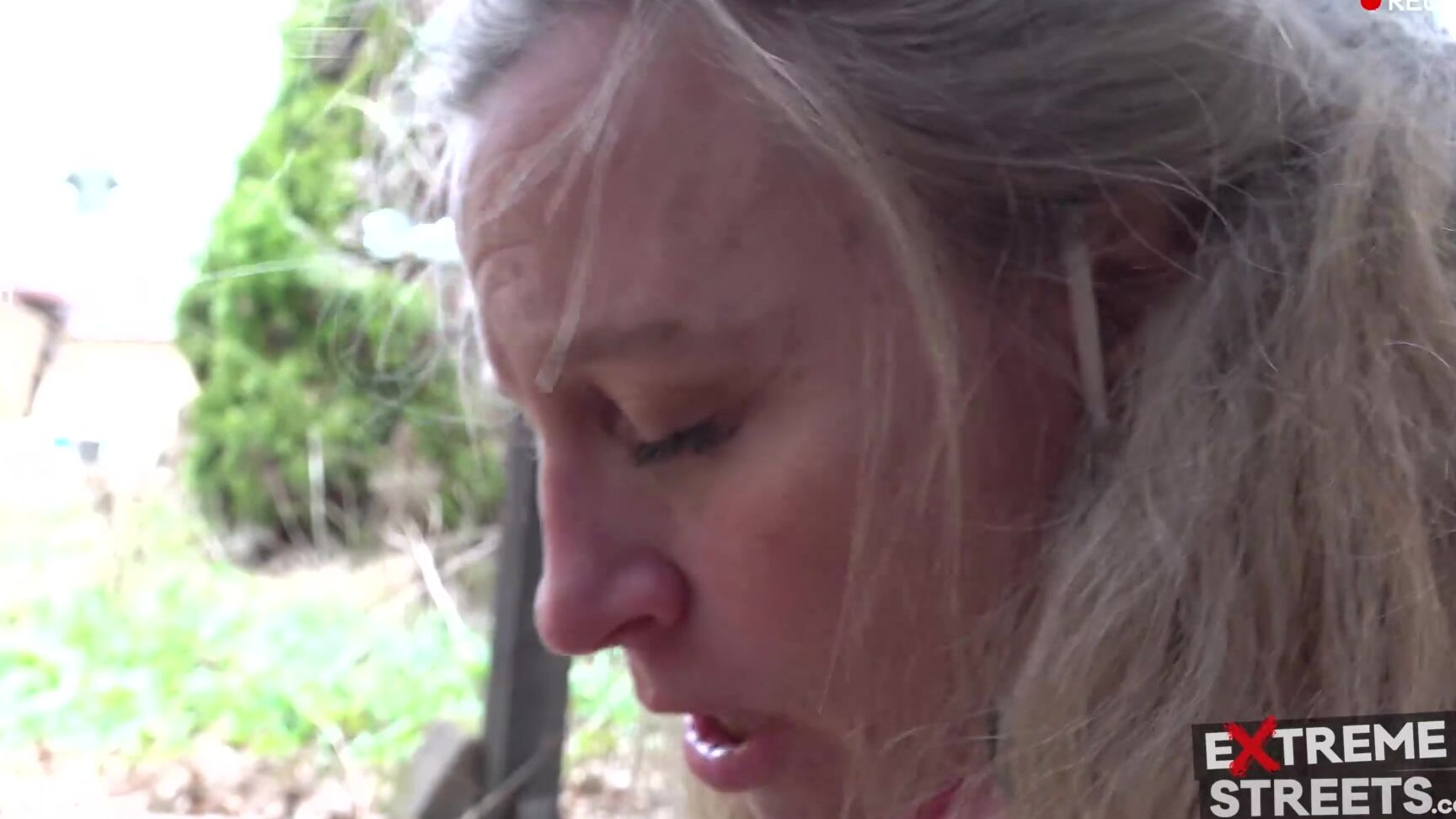 Etremestreets 14 10K Usd Vaginal Prolapse