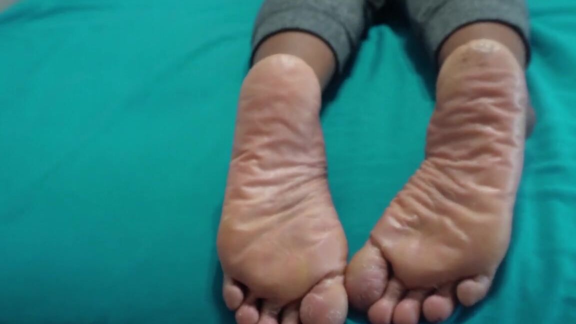 Marilyn Cutes Feet Nicknamed Marilynebonyfeet 05 04 2024 Onlyfans Video You Dont Need To Ask My Permission Put Your Face On My Soles