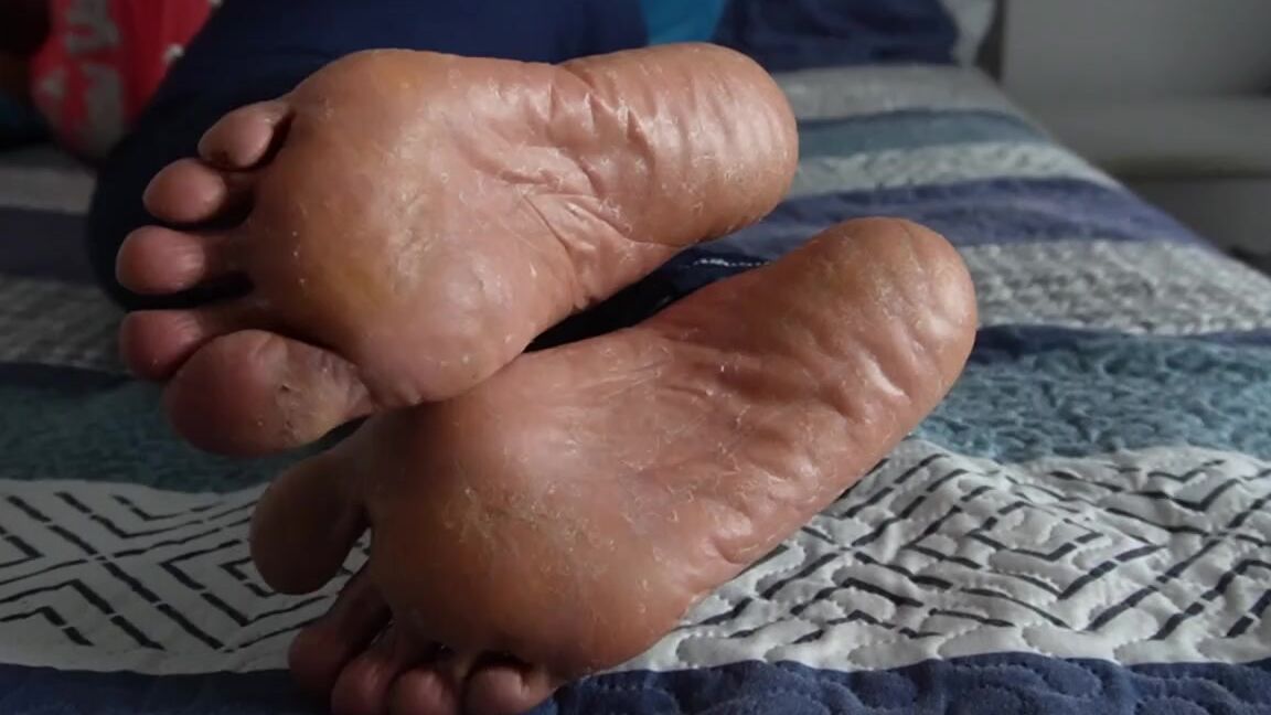 Marilyn Cutes Feet Nicknamed Marilynebonyfeet 09 03 2023 Onlyfans Video My Soles Are Going To Make You Horny