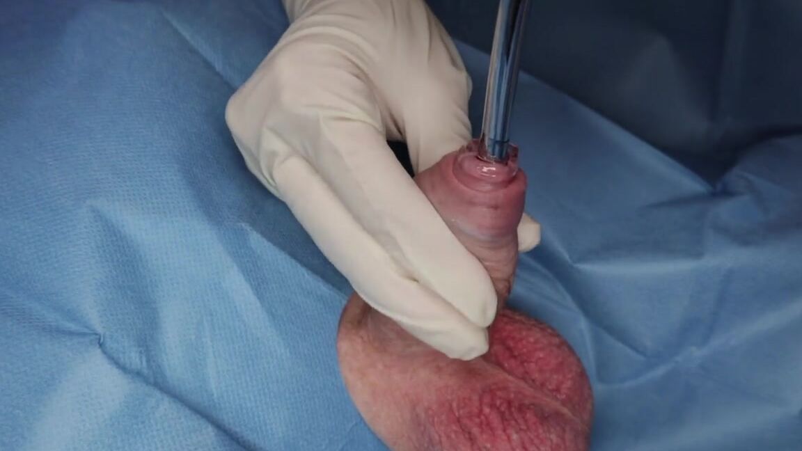 Sounding Catheterisation And Anal Dilation