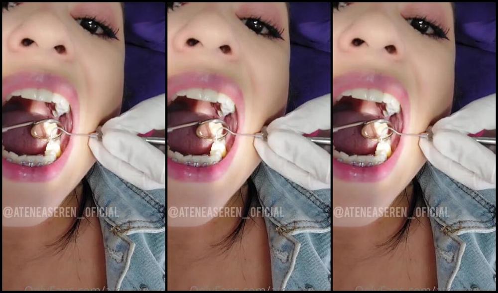 Atenea Seren Nicknamed Ateneaseren Onlyfans Video I Really Love Going To My Dentist Appointments