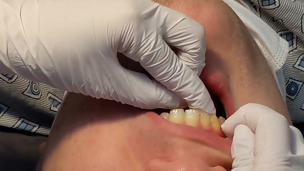 Mei Glover Nicknamed Meiglover 03 17 2024 Onlyfans Video Flossing My Husbands Teeth