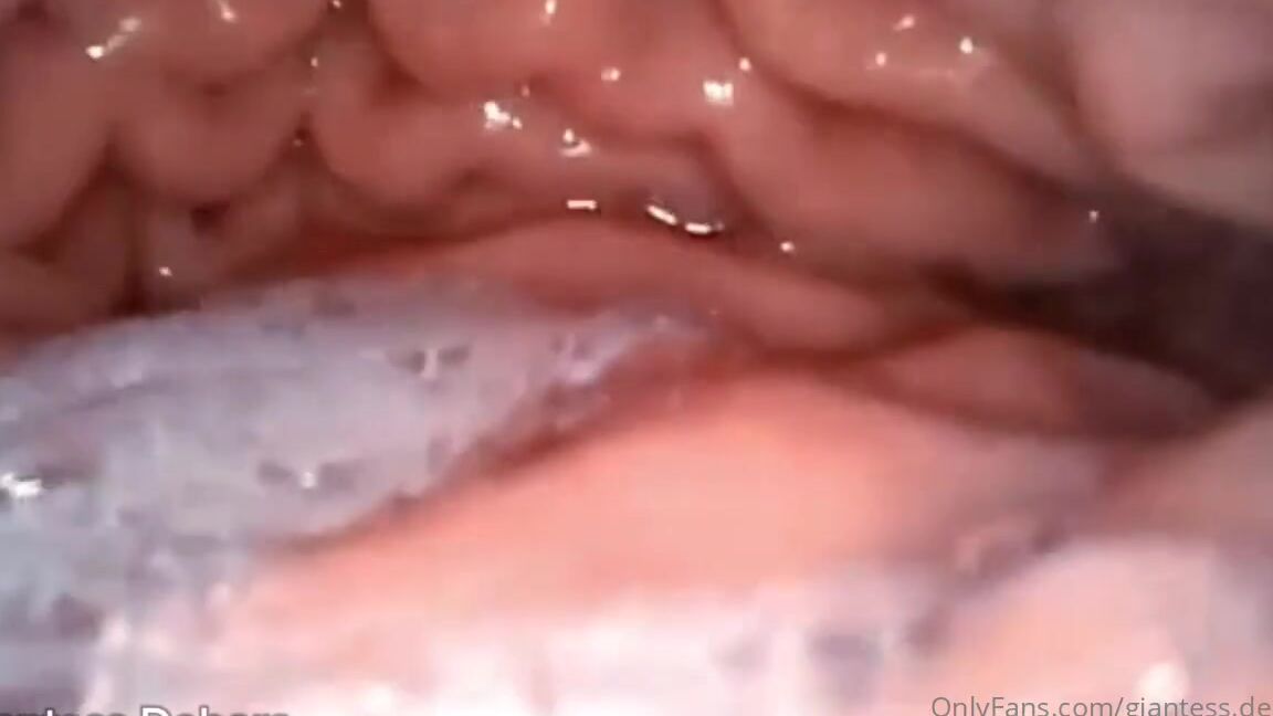 Giantess Vore Debora Nicknamed Giantess Debora 08 28 2024 Onlyfans Video Vore Inside My Belly With Endoscopy 10Min Get It For 10