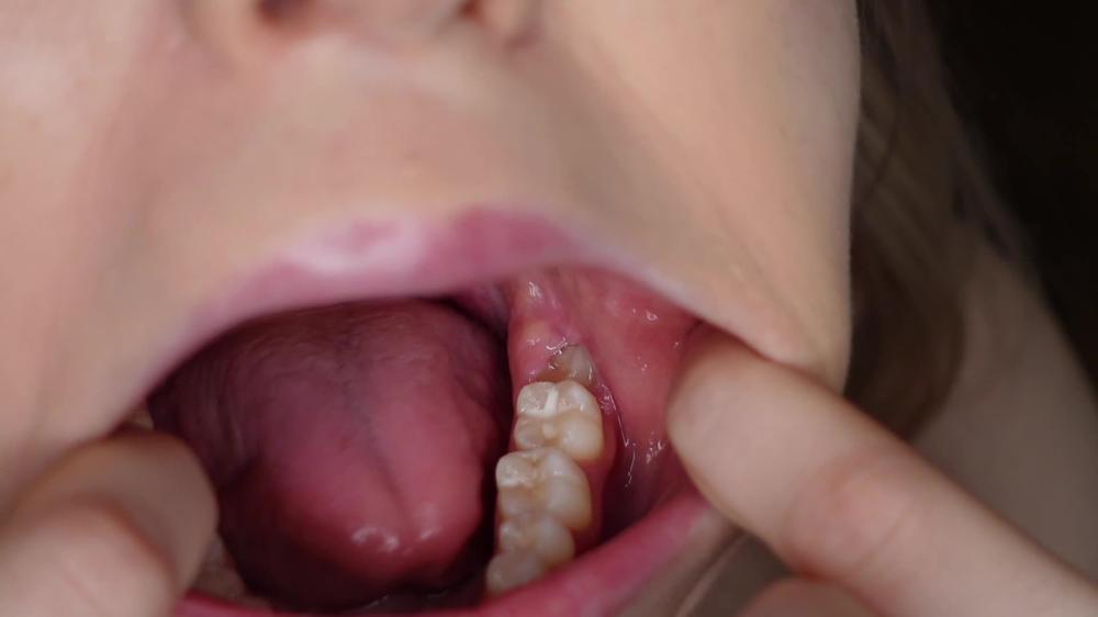 Poster for Manyvids Star - Teeth And Molars Tour Dental History - Sofie Skye - Throat Fetish, Tongue Fetish (Софи Скай Фетиш Языка)