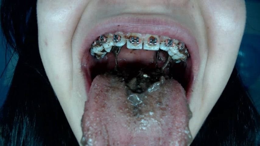 Poster for Manyvids Star - Mia_Isabella3 - Miaisabella3 Close Up Dirty - Braces, Food (My_Isabella3 Еда)